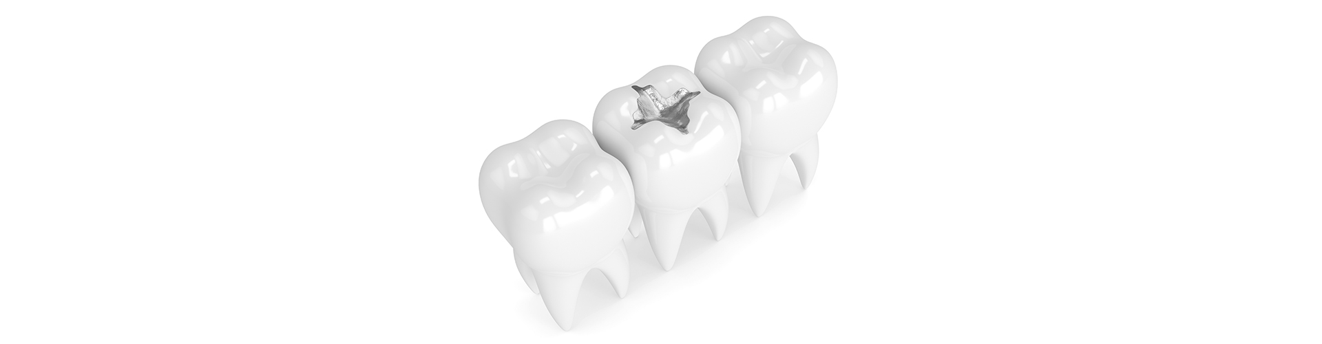 MercurySafeDentistry Sacramento Natural Dentistry